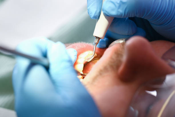 Best Dentist for Tooth Abscess  in Orange City, IA