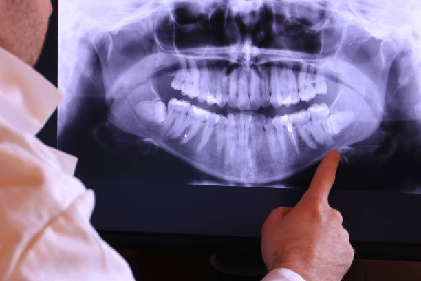 Best Knocked-Out Tooth Emergency  in Orange City, IA