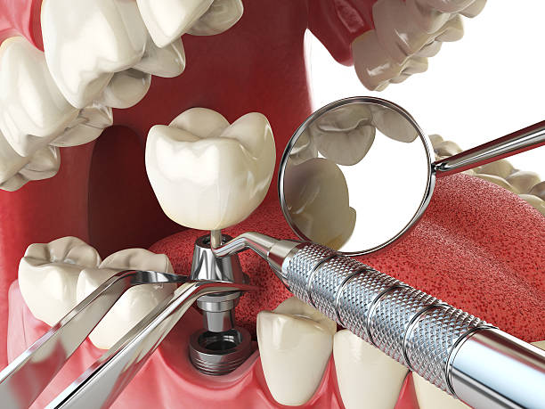 Best Emergency Gum Pain Relief  in Orange City, IA